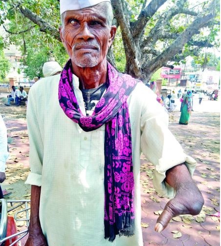 Who will support this old man? | या दिव्यांंग वृद्धाला ‘आधार’ देणार कोण? Who will support this old man? | या दिव्यांंग वृद्धाला ‘आधार’ देणार कोण?