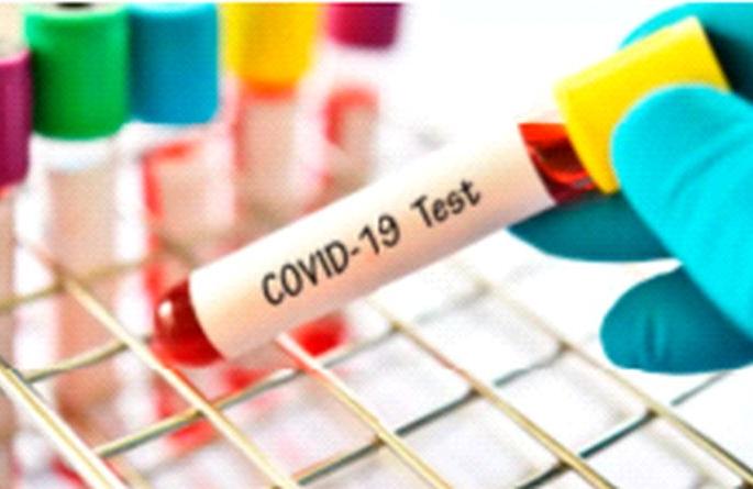 District leads in corona tests | कोरोना चाचण्यांमध्ये जिल्हा आघाडीवर District leads in corona tests | कोरोना चाचण्यांमध्ये जिल्हा आघाडीवर