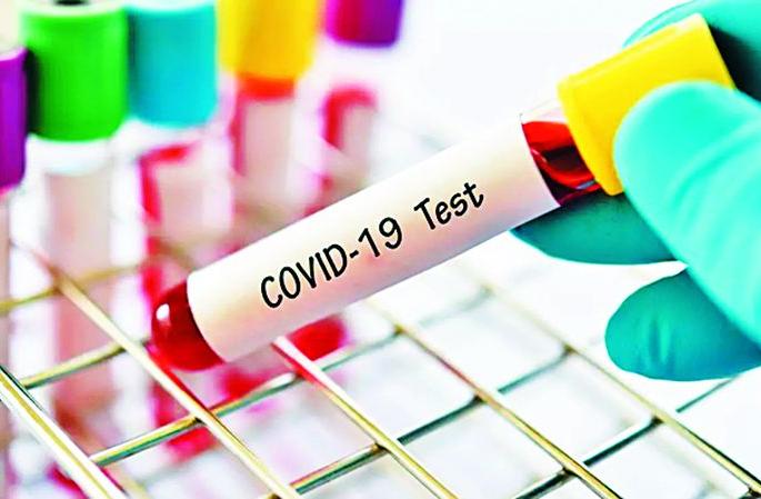 The target is 2 thousand 160 Carana tests per day | दररोज 2 हजार 160 काेराेना चाचण्यांचे उद्दिष्ट
