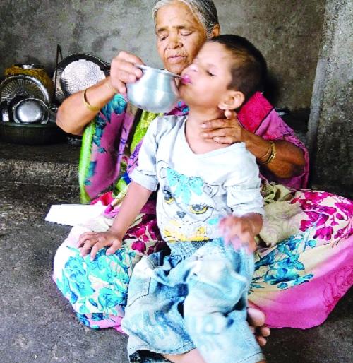 The darkness of poverty in the life of the blind monster, the need for help - only if we get the medicine | अंध सम्राटच्या जीवनात गरिबीचाही अंधार -बाळाला मदतीची गरज -औषधोपचार मिळाले तरच दिसणार