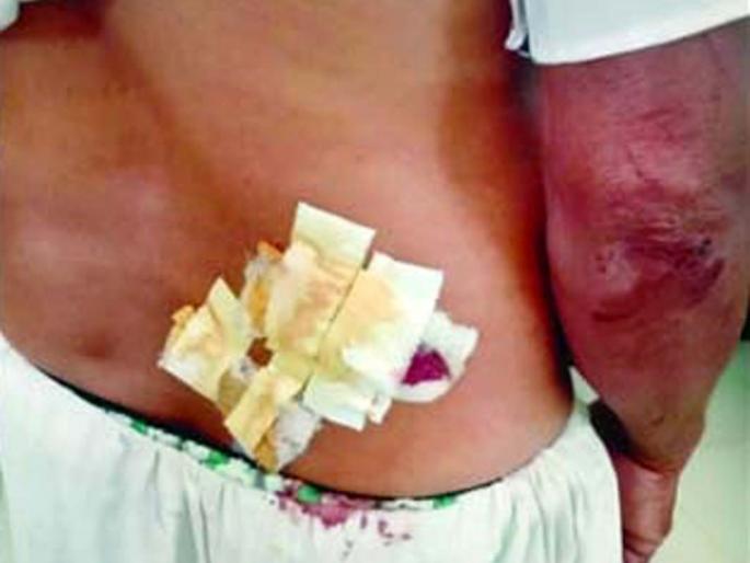 Two injured in Leo's attack in Maal-Hala Shivar | म-हळ शिवारात बिबट्याच्या हल्ल्यात दोघे जखमी