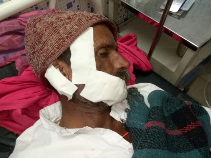 Mid-night attack on a leopard; The incident at pargaon tarfe aale of Pune district | बिबट्याचा मेंढपाळावर मध्यरात्री हल्ला; पुणे जिल्ह्यातील पारगाव तर्फे आळे येथील घटना Mid-night attack on a leopard; The incident at pargaon tarfe aale of Pune district | बिबट्याचा मेंढपाळावर मध्यरात्री हल्ला; पुणे जिल्ह्यातील पारगाव तर्फे आळे येथील घटना