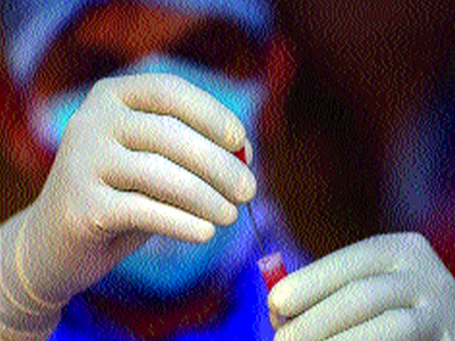 Nashik gets 4,000 antigen kits! | नाशिकला मिळाल्या चार हजार अ‍ॅँटिजेन किट !