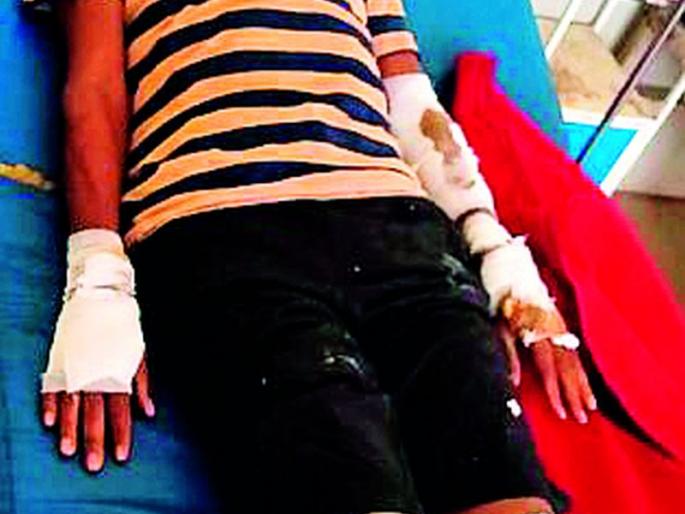 Couple injured in leopard attack | बिबट्याच्या धडकेत दाम्पत्य जखमी