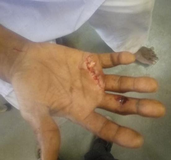 Wild boar attack in Dhakalgaon; four injured | रानडुकरांचा धाकलगावात हैदोस; चौघे जखमी