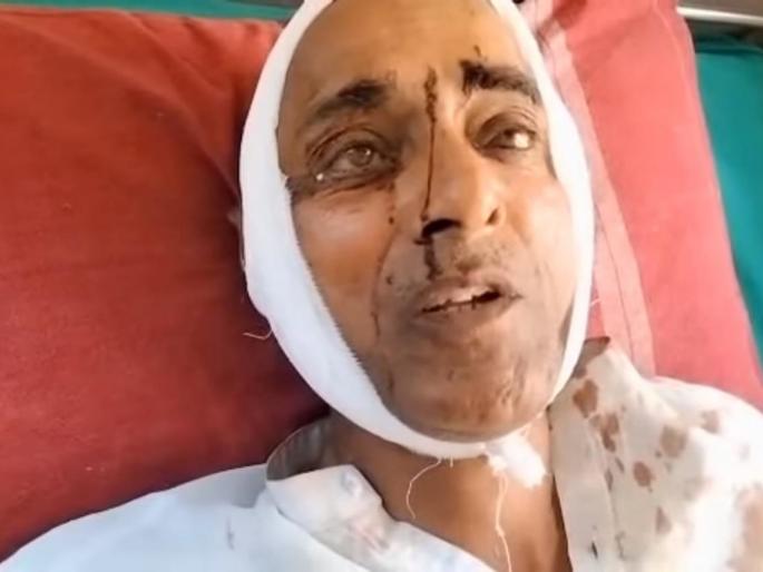 Mob attack in slaughterhouse area; Social workers from Solapur injured | कत्तलखाना परिसरात जमावाचा हल्ला; सोलापूरचे सामाजिक कार्यकर्ते जखमी