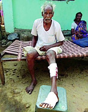 Three injured in Randukar attack | रानडुकराच्या हल्ल्यात तिघे जखमी