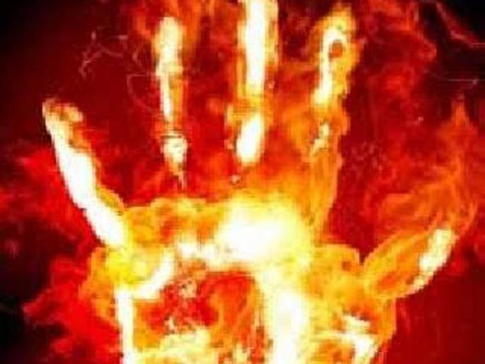 Diseases of the Burning Ward are Behal | जळित वॉर्डमधील रूग्णांचे बेहाल Diseases of the Burning Ward are Behal | जळित वॉर्डमधील रूग्णांचे बेहाल