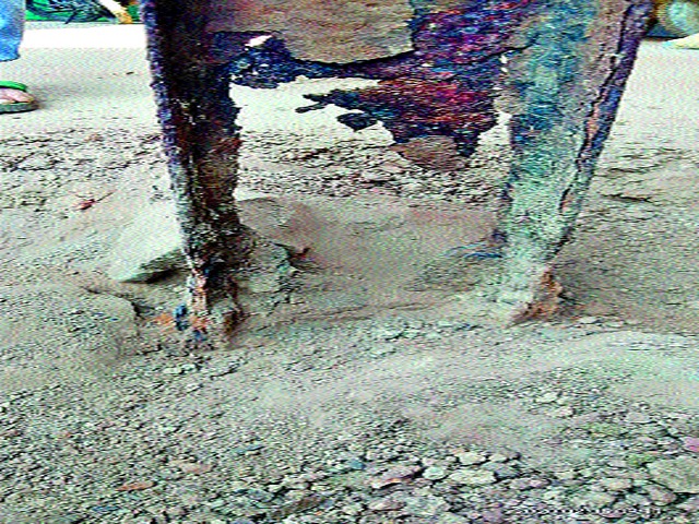 Jeopardizing the safety of citizens | नागरिकांची सुरक्षा धोक्यात