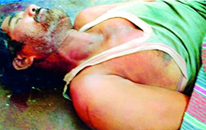 Police convert suicide after killing husband | पतीची हत्या होऊनही पोलिसांनी केले आत्महत्येत रुपांतर Police convert suicide after killing husband | पतीची हत्या होऊनही पोलिसांनी केले आत्महत्येत रुपांतर