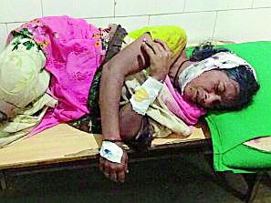 Arattondi assault on Kurhadi woman | अरततोंडीत महिलेवर कुऱ्हाडीने हल्ला Arattondi assault on Kurhadi woman | अरततोंडीत महिलेवर कुऱ्हाडीने हल्ला