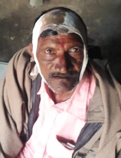 Four farmers were injured in a hailstorm attack | तरसाच्या हल्ल्यात चार शेतकऱ्यांसह मजूर जखमी Four farmers were injured in a hailstorm attack | तरसाच्या हल्ल्यात चार शेतकऱ्यांसह मजूर जखमी