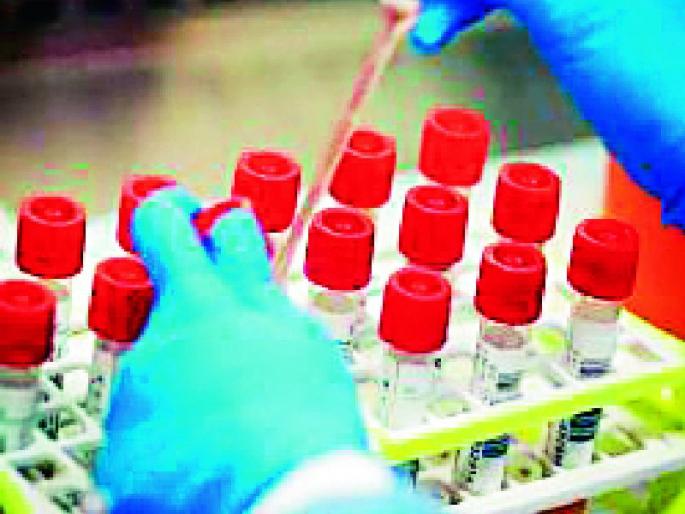 Preparing to buy one lakh antigen kits | एक लाख अॅन्टीजेन किट खरेदी करण्याची तयारी Preparing to buy one lakh antigen kits | एक लाख अॅन्टीजेन किट खरेदी करण्याची तयारी