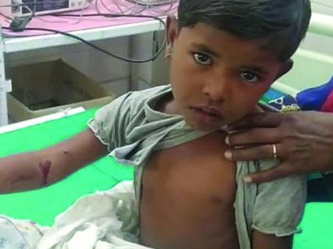 Four children injured in dog attack in Karwand | करवंडमध्ये कुत्र्याच्या हल्ल्यात चार बालके जखमी Four children injured in dog attack in Karwand | करवंडमध्ये कुत्र्याच्या हल्ल्यात चार बालके जखमी