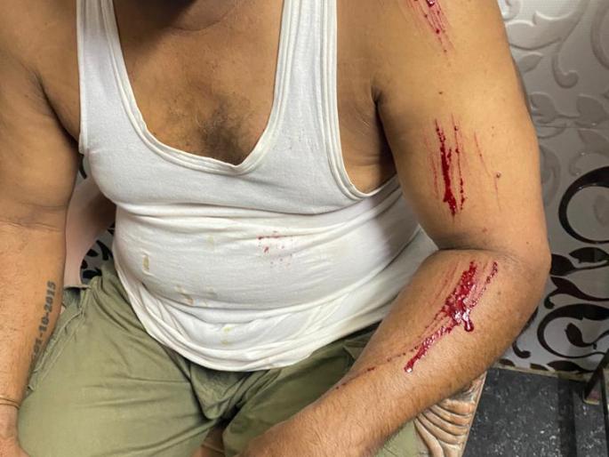Leopard attacks back despite leg fractures | पाय फ्रॅक्चर असूनही बिबट्याचा परतवला हल्ला Leopard attacks back despite leg fractures | पाय फ्रॅक्चर असूनही बिबट्याचा परतवला हल्ला