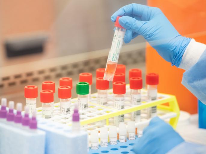 Demand for Corona Testing Lab in the District | जिल्ह्यात कोरोना टेस्टिंग लॅबची मागणी Demand for Corona Testing Lab in the District | जिल्ह्यात कोरोना टेस्टिंग लॅबची मागणी
