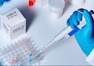 Waiting a few days again for RTPCR | आरटीपीसीआरसाठी पुन्हा काही दिवस वेटींग Waiting a few days again for RTPCR | आरटीपीसीआरसाठी पुन्हा काही दिवस वेटींग