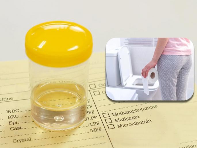 Clear urine color alcohol over hydration urine other color and causes | लघवीचा रंग पूर्णपणे क्लिअर दिसणं म्हणजे या समस्यांचे आहेत संकेत, वेळीच व्हा सावध! Clear urine color alcohol over hydration urine other color and causes | लघवीचा रंग पूर्णपणे क्लिअर दिसणं म्हणजे या समस्यांचे आहेत संकेत, वेळीच व्हा सावध!