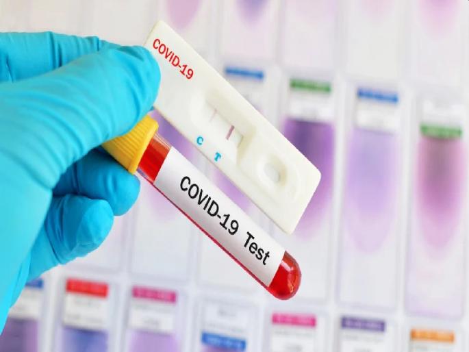 Coronavirus: Fight Coronavirus! Preparation of action plan in Bhiwandi; There will be 300 free trials every day | Coronavirus: लढा कोरोनाशी! भिवंडीमध्ये अ‍ॅक्शन प्लान तयार; दररोज होणार ३०० मोफत चाचण्या