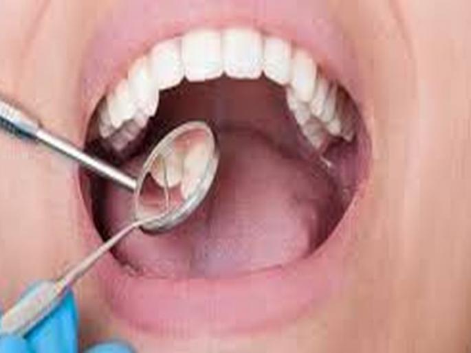 1 lakh 61 thousand patients in Jalgaon district is unhealthy | जळगाव जिल्ह्यात 1 लाख 61 हजार रुग्णांचे मुख स्वास्थ अस्वच्छ 1 lakh 61 thousand patients in Jalgaon district is unhealthy | जळगाव जिल्ह्यात 1 लाख 61 हजार रुग्णांचे मुख स्वास्थ अस्वच्छ