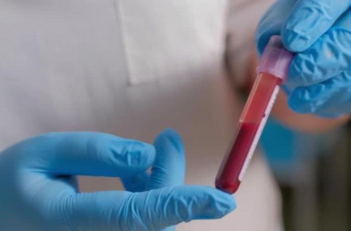 380 corona patients in Vidarbha; new two in Amravati and one in Nagpur | विदर्भात कोरोनाबाधित रुग्णांची संख्या ३८०; अमरावतीत दोन तर नागपुरात एक रुग्ण 380 corona patients in Vidarbha; new two in Amravati and one in Nagpur | विदर्भात कोरोनाबाधित रुग्णांची संख्या ३८०; अमरावतीत दोन तर नागपुरात एक रुग्ण