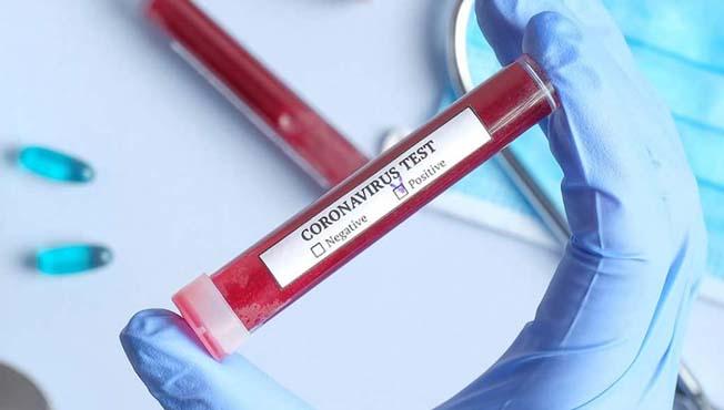 Coronavirus: not enough tests from states; Maharashtra needs to increase tests, Center concerned | Coronavirus:राज्यांकडून पुरेशा चाचण्या नाहीत; महाराष्ट्राने चाचण्या वाढवण्याची गरज, केंद्र चिंतेत Coronavirus: not enough tests from states; Maharashtra needs to increase tests, Center concerned | Coronavirus:राज्यांकडून पुरेशा चाचण्या नाहीत; महाराष्ट्राने चाचण्या वाढवण्याची गरज, केंद्र चिंतेत