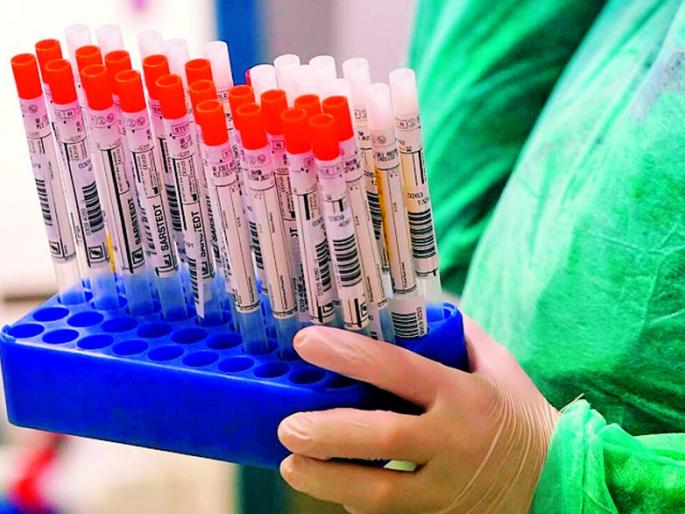 Antigen testing of 75,000 individuals | 75 हजार व्यक्तींची ॲन्टीजेन चाचणी Antigen testing of 75,000 individuals | 75 हजार व्यक्तींची ॲन्टीजेन चाचणी