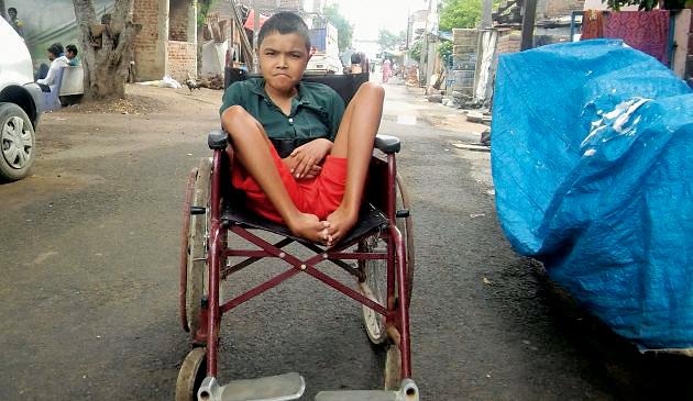 Medical science also lapsed before Sameer's illness | समीरच्या आजारापुढे वैद्यकशास्त्रही पांगळे Medical science also lapsed before Sameer's illness | समीरच्या आजारापुढे वैद्यकशास्त्रही पांगळे