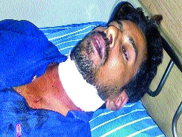 Yevla: The youth of the moth was cut off by a nylon mache | येवला : पतंगाच्या नायलॉन मांजाने कापला येवल्यात युवकाचा गळा Yevla: The youth of the moth was cut off by a nylon mache | येवला : पतंगाच्या नायलॉन मांजाने कापला येवल्यात युवकाचा गळा