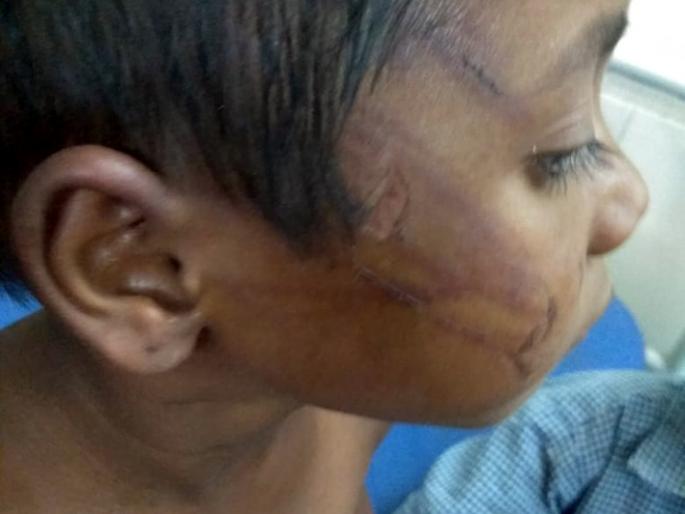 Parbhani: Marakas killing; Crime against father | परभणी : बालकास मारहाण; पित्याविरुद्ध गुन्हा Parbhani: Marakas killing; Crime against father | परभणी : बालकास मारहाण; पित्याविरुद्ध गुन्हा