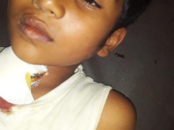 Baby rescued from attack | बिबट्याच्या हल्ल्यातून बालक बचावले Baby rescued from attack | बिबट्याच्या हल्ल्यातून बालक बचावले