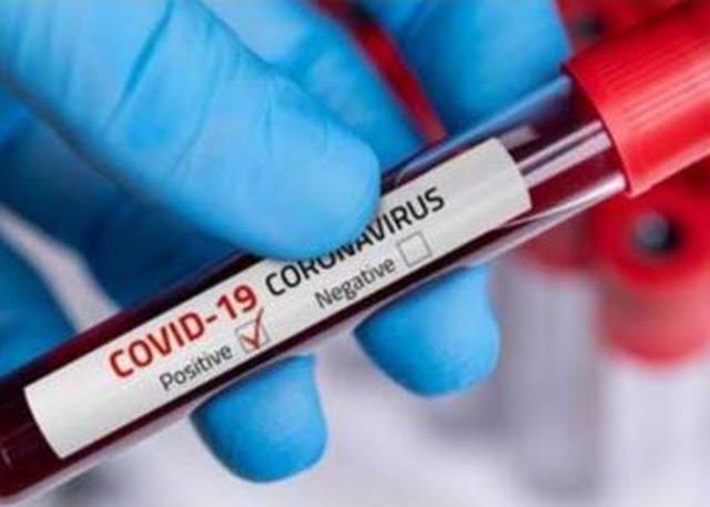 Corona virus: Worrying! 675 new corona patients is increasing on Sunday in the pune district, total number of patients was 15 thousand 679 | Corona virus : चिंताजनक! पुणे जिल्ह्यात रविवारी तब्बल 675 कोरोनाबाधितांची वाढ, एकूण रुग्णसंख्या 15 हजार 679 Corona virus: Worrying! 675 new corona patients is increasing on Sunday in the pune district, total number of patients was 15 thousand 679 | Corona virus : चिंताजनक! पुणे जिल्ह्यात रविवारी तब्बल 675 कोरोनाबाधितांची वाढ, एकूण रुग्णसंख्या 15 हजार 679
