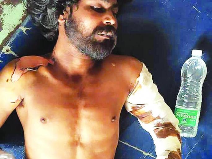 Acid attack on Mentaly ill person | मनोरूग्णावर अॅसीड हल्ला Acid attack on Mentaly ill person | मनोरूग्णावर अॅसीड हल्ला