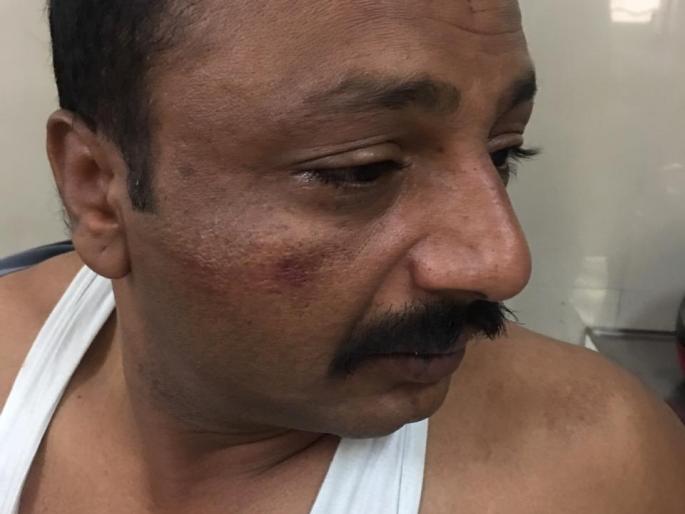 Striking the Challenge of the Sand Amnesty | वाळू माफीयांची तलाठ्यास मारहाण Striking the Challenge of the Sand Amnesty | वाळू माफीयांची तलाठ्यास मारहाण