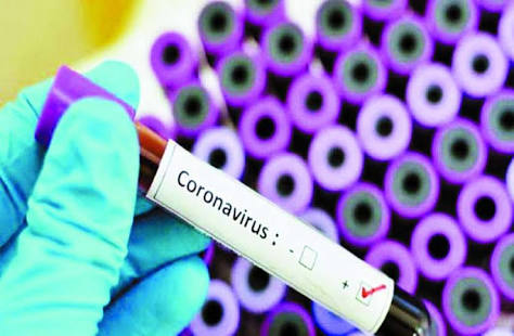 Corona virus: 1598 corona infections in one day in Pune district; Total number 35 thousand 997 | Corona virus :पुणे जिल्ह्यात एका दिवसात १५९८ कोरोनाबाधित; एकूण संख्या ३५ हजार ९९७ Corona virus: 1598 corona infections in one day in Pune district; Total number 35 thousand 997 | Corona virus :पुणे जिल्ह्यात एका दिवसात १५९८ कोरोनाबाधित; एकूण संख्या ३५ हजार ९९७