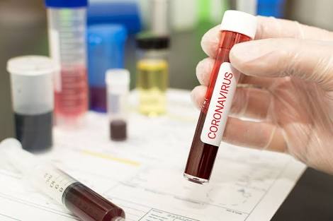 Corona virus : An increase of 523 new patients in a day in Pune ,total number of patients on 16 thousands 125 | Corona virus : पुण्यात रविवारी दिवसभरात ५२३ कोरोना रुग्णांची वाढ , एकूण बधितांची संख्या १६ हजार १२५ वर Corona virus : An increase of 523 new patients in a day in Pune ,total number of patients on 16 thousands 125 | Corona virus : पुण्यात रविवारी दिवसभरात ५२३ कोरोना रुग्णांची वाढ , एकूण बधितांची संख्या १६ हजार १२५ वर