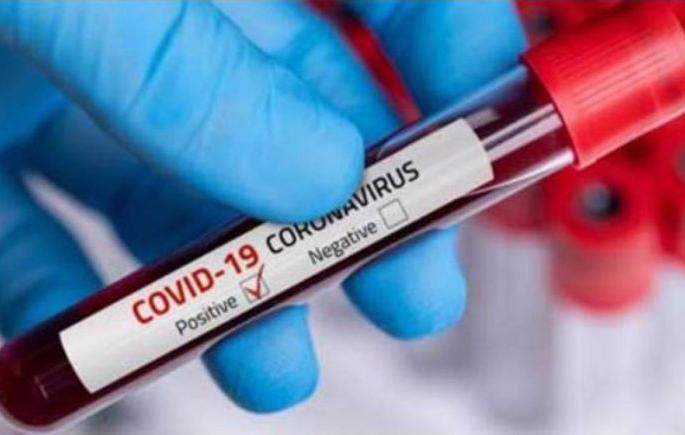 Corona Virus in Nagpur: 319 new positive in Nagpur, 5 deaths | CoronaVirus in Nagpur : नागपुरात ३१९ नवीन पॉझिटिव्ह, ५ जणांचा मृत्यू Corona Virus in Nagpur: 319 new positive in Nagpur, 5 deaths | CoronaVirus in Nagpur : नागपुरात ३१९ नवीन पॉझिटिव्ह, ५ जणांचा मृत्यू