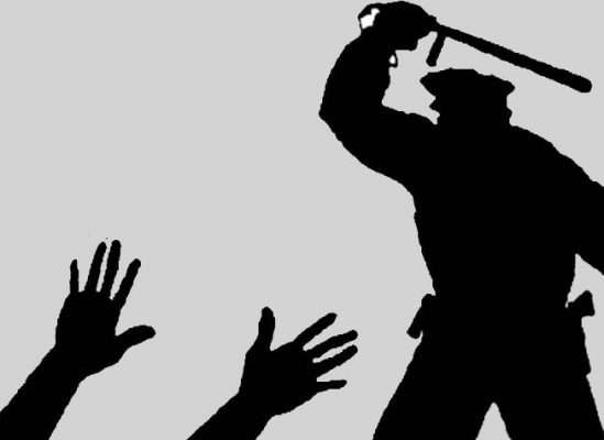 Beating by police, warning of agitation | पोलिसांकडून मारहाण, आंदोलनाचा इशारा Beating by police, warning of agitation | पोलिसांकडून मारहाण, आंदोलनाचा इशारा