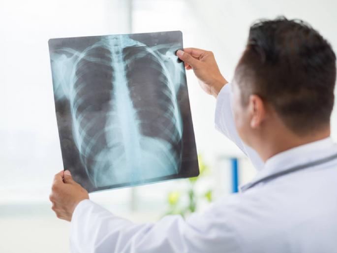 Parents beware! School mischief goes unpunished, 13-year-old boy gets stuck in his lungs...; Mumbai incident | पालकांनो सावधान! शाळेतील खोडसाळपणा नडला,१३ वर्षाच्या मुलाच्या फुफ्फुसात अडकली...; मुंबईतील घटना Parents beware! School mischief goes unpunished, 13-year-old boy gets stuck in his lungs...; Mumbai incident | पालकांनो सावधान! शाळेतील खोडसाळपणा नडला,१३ वर्षाच्या मुलाच्या फुफ्फुसात अडकली...; मुंबईतील घटना