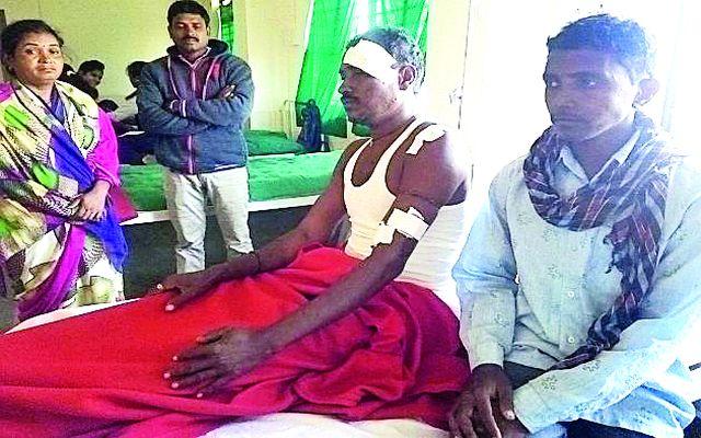 He is seriously injured in the beleaguered attack | अस्वलाच्या हल्ल्यात इसम गंभीर जखमी He is seriously injured in the beleaguered attack | अस्वलाच्या हल्ल्यात इसम गंभीर जखमी