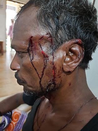 A leopard attack on person; The buffalo stopped the horns and saved lives | गुराख्यावर घातली बिबट्याने झडप; म्हशीने शिंगे रोखून वाचवले प्राण A leopard attack on person; The buffalo stopped the horns and saved lives | गुराख्यावर घातली बिबट्याने झडप; म्हशीने शिंगे रोखून वाचवले प्राण