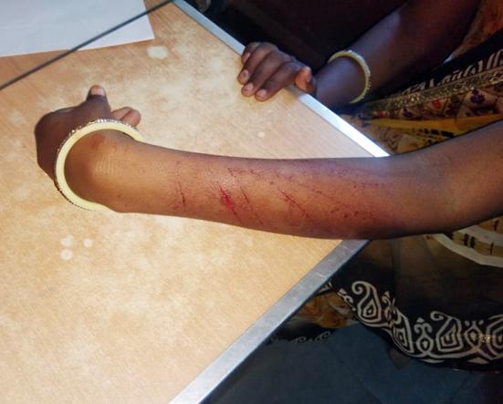 In the Umbarchid, the blade has a blade warrant for the villagers | उंबरखेड्यात अज्ञाताकडून ग्रामसेविकेवर ब्लेडने वार In the Umbarchid, the blade has a blade warrant for the villagers | उंबरखेड्यात अज्ञाताकडून ग्रामसेविकेवर ब्लेडने वार