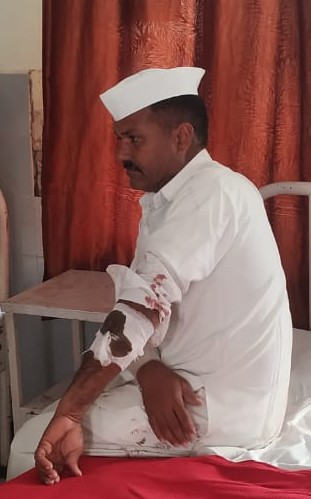 Farmer injured in attack | बिबट्याच्या हल्ल्यात शेतकरी जखमी Farmer injured in attack | बिबट्याच्या हल्ल्यात शेतकरी जखमी