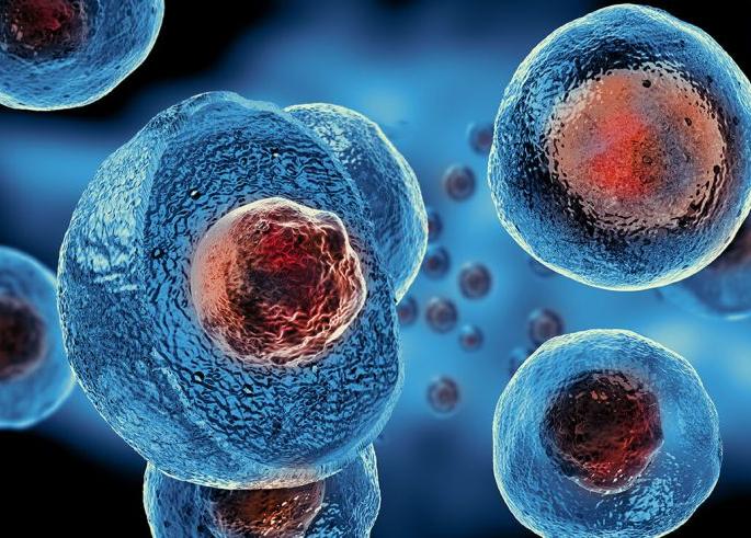 Now ‘stem cell therapy’ on serious patients of corona! | कोरोनाच्या गंभीर रुग्णांवर आता ‘स्टेम सेल थेरपी’! Now ‘stem cell therapy’ on serious patients of corona! | कोरोनाच्या गंभीर रुग्णांवर आता ‘स्टेम सेल थेरपी’!