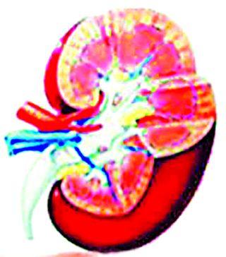Be careful! Kidney Disease Increase | सावधान! मूत्रपिंडाच्या आजारात वाढ Be careful! Kidney Disease Increase | सावधान! मूत्रपिंडाच्या आजारात वाढ
