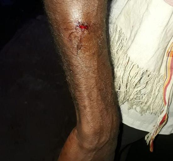 Vanar massacre while saving the little girl | लहान मुलीला वाचविताना वानराचा मजुरावर हल्ला Vanar massacre while saving the little girl | लहान मुलीला वाचविताना वानराचा मजुरावर हल्ला