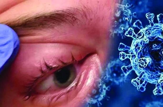 There is an increase in the number of patients with mucomycosis in Buldana district | बुलडाणा जिल्ह्यात म्युकरमायकोसिसच्या रुग्णांच्या संख्येत होतेय वाढ There is an increase in the number of patients with mucomycosis in Buldana district | बुलडाणा जिल्ह्यात म्युकरमायकोसिसच्या रुग्णांच्या संख्येत होतेय वाढ