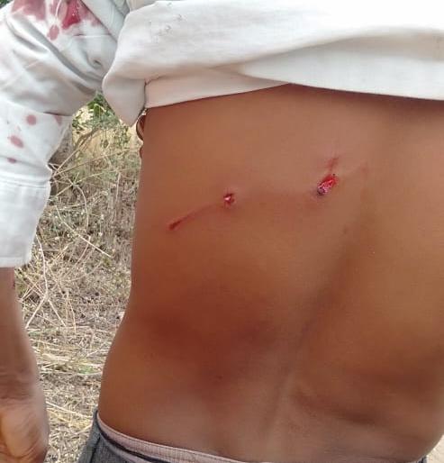 Leopard attacks youth in Bhardupari field | बिबट्याचा भरदुपारी शेतात युवकावर हल्ला