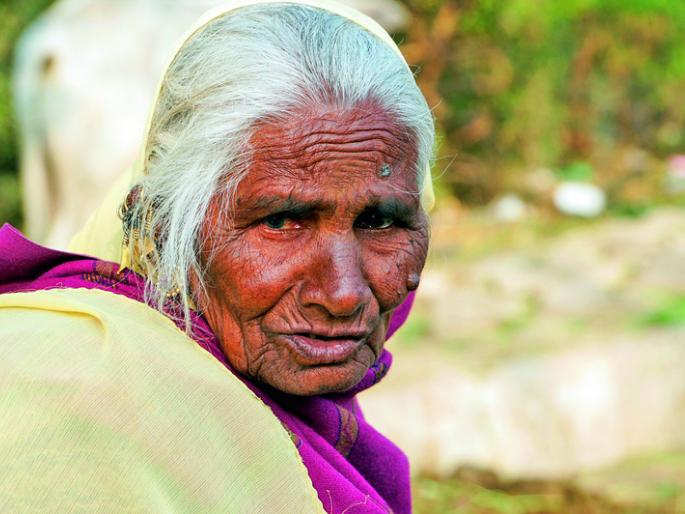 Five hundred senior citizens of Solapur district await cataract surgery | सोलापूर जिल्ह्यातील पाचशे ज्येष्ठ नागरिकांच्या मोतीबिंदू शस्त्रक्रिया प्रतीक्षेत Five hundred senior citizens of Solapur district await cataract surgery | सोलापूर जिल्ह्यातील पाचशे ज्येष्ठ नागरिकांच्या मोतीबिंदू शस्त्रक्रिया प्रतीक्षेत