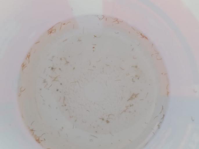 Very lively larvae through the tube in Nandurshingota | नांदूरशिंगोटेत नळाद्वारे चक्क जिवंत अळी Very lively larvae through the tube in Nandurshingota | नांदूरशिंगोटेत नळाद्वारे चक्क जिवंत अळी